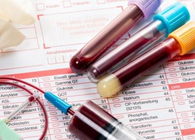 هر آنچه ضروری است درباره آزمایش خون بدانید