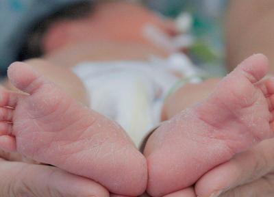 ژنی که می تواند بی درد بودن زایمان برخی زنان را توضیح دهد